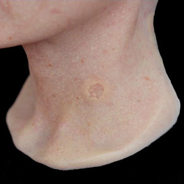 Out Of Kit Healed Bullet Hole Scar 1 Special FX 2 Out Of Kit Healed Bullet Hole Scar 1 Special FX