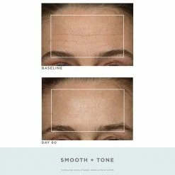 NuFACE Trinity Pro Facial Toning Kit + Wrinkle Reducer 17 NuFACE Trinity Pro Facial Toning Kit + Wrinkle Reducer