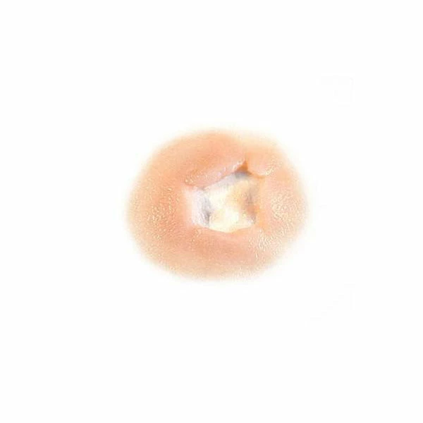 Out Of Kit Exit Wound (Small) 1 Out Of Kit Exit Wound (Small)