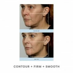 NuFACE Trinity Facial Toning Kit 12 NuFACE Trinity Facial Toning Kit